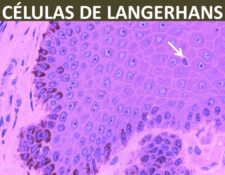 células de langerhans