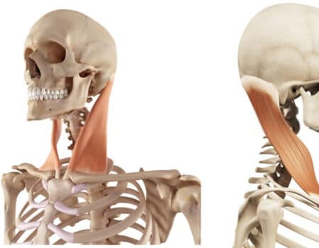 músculo esternocleidomastoideo