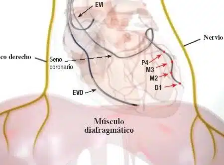 Nervio Frénico
