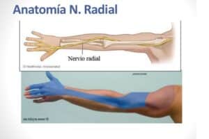 nervio radial