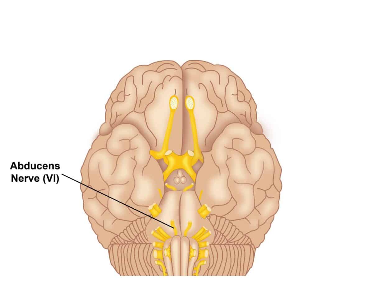 nervio abducens