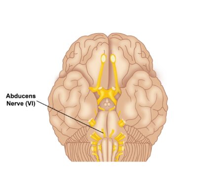 nervio abducens