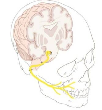 Nervio facial (VII par craneal): trayecto y ramas terminales en la cara