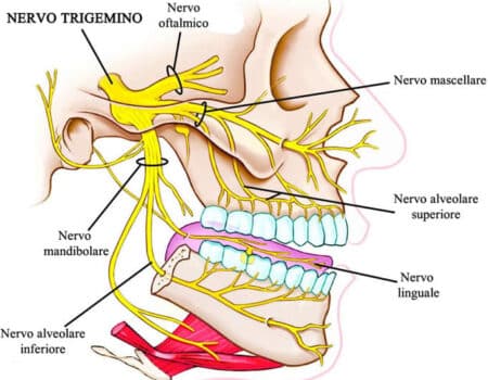 Nervio trigémino (V par craneal): núcleos, ganglio del trigémino y sus tres divisiones (oftálmico, maxilar, mandibular)