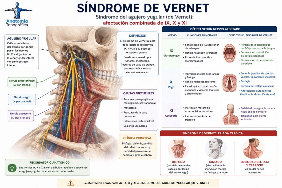 Nervio vago (X par craneal): anatomía, funciones, ramas y patología Síndrome del agujero yugular (de Vernet): afectación combinada de IX, X y XI