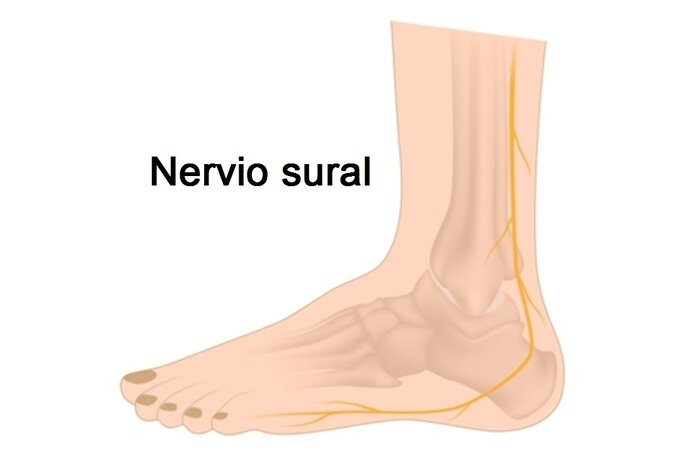 nervio sural