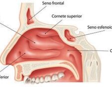 cornetes nasales