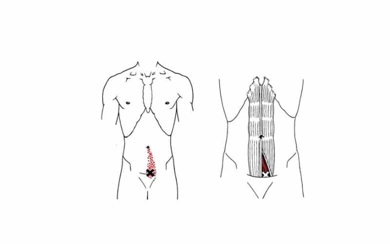 Músculo piramidal del abdomen Músculo piramidal del abdomen