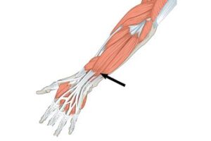 Músculo extensor del meñique extensor del meñique