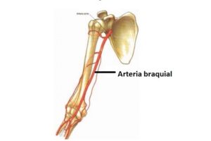 arteria braquial