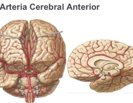 Arteria cerebral anterior
