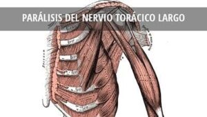 Nervio torácico largo (origen, curso anatómico, suministro, patología)
