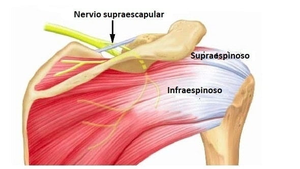 Тендиноз надостной мышцы плечевого сустава. Suprascapular nerve. Ганглион плечевого сустава. N infraspinatus нерв.