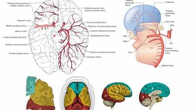 arteria cerebral posterior