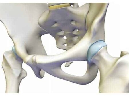 Articulación de la cadera
