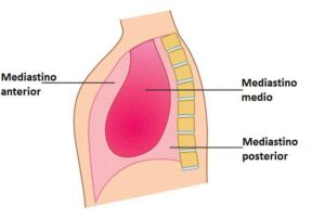 Mediastino anterior