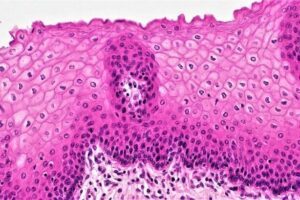Epitelio estratificado