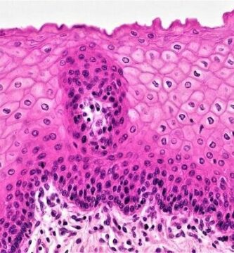 Epitelio estratificado