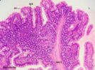 Histología del intestino delgado