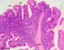 Histología del intestino delgado