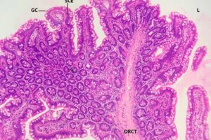 Histología del intestino delgado