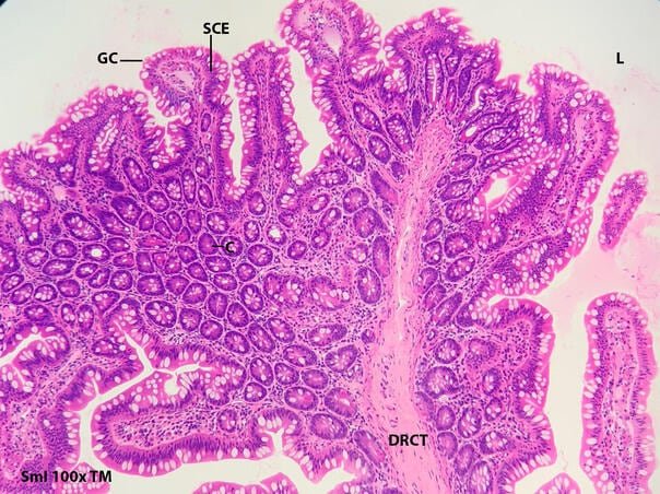 ampolla de vater histología