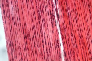 tejido conectivo denso