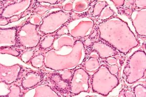 Histología de la glándula tiroides