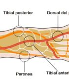 Arteria tibial anterior