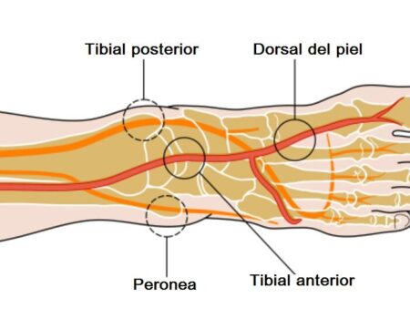 Arteria tibial anterior