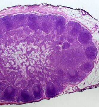 ganglios linfáticos