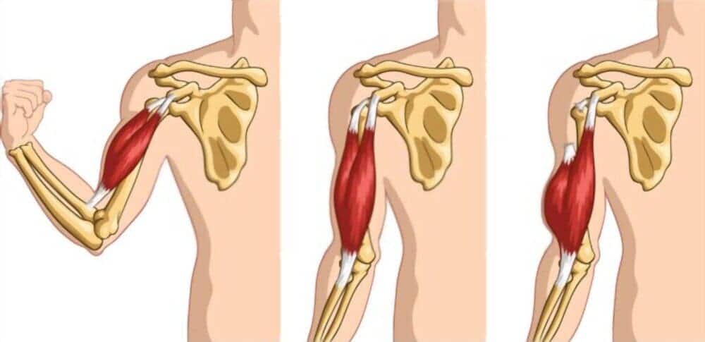 Musculo Braquial Anterior