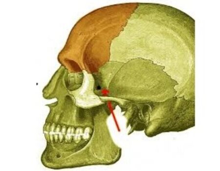 Fosa infratemporal