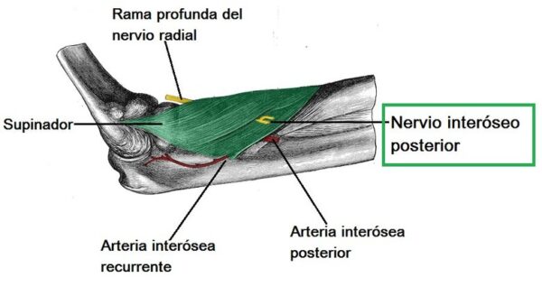 Nervio interóseo posterior