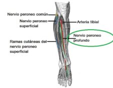 Nervio peroneo profundo