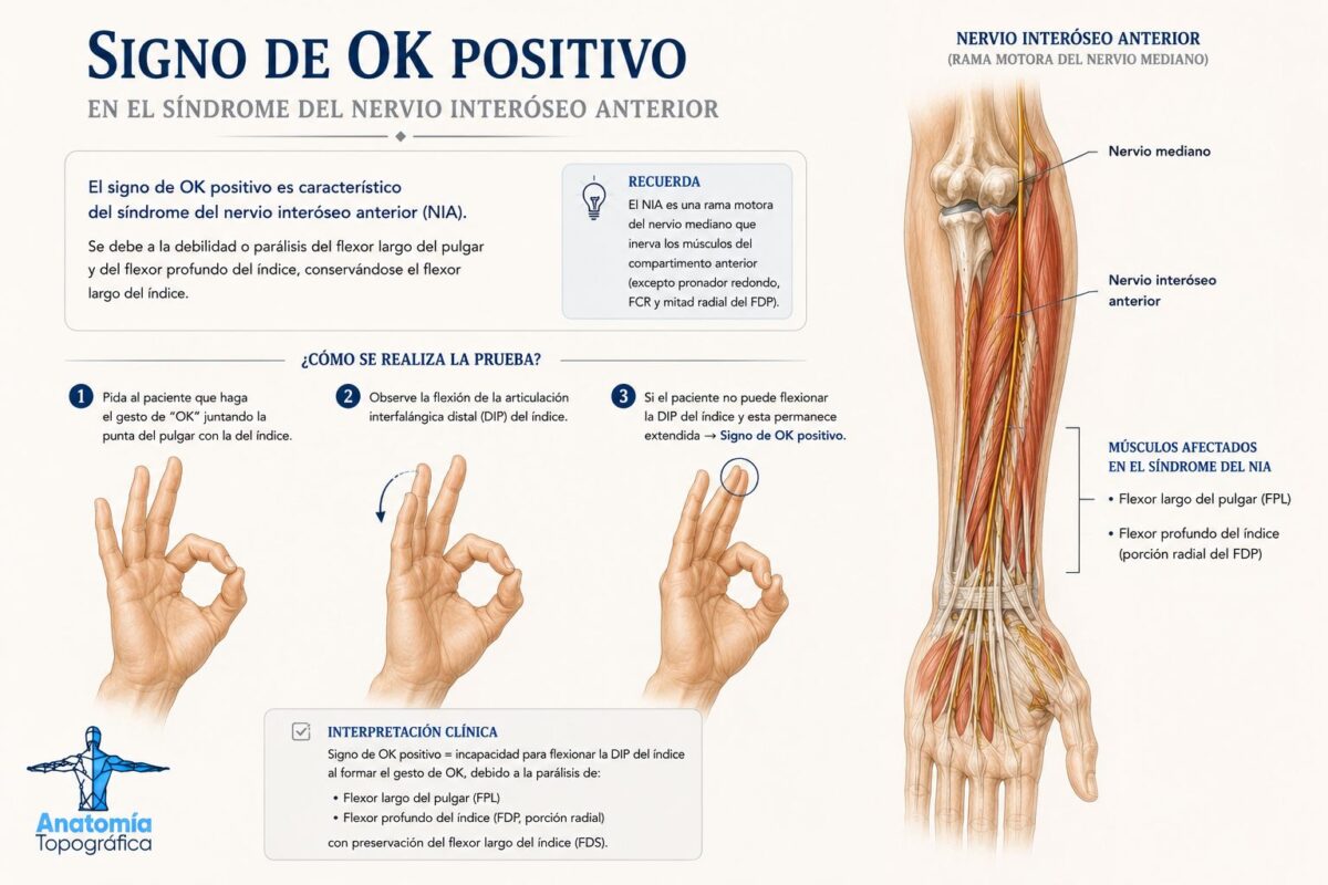 Signo de OK positivo en el síndrome del nervio interóseo anterior