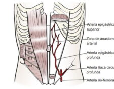 Arteria epigástrica superior