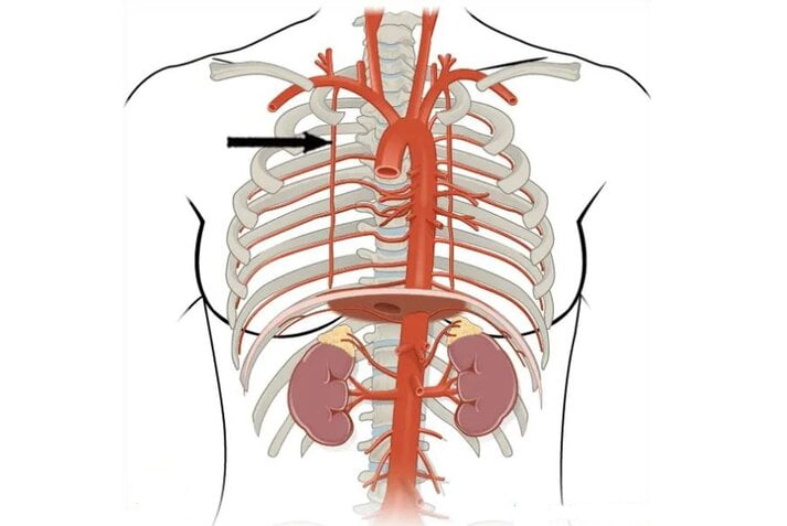 Arteria torácica interna Arteria torácica interna