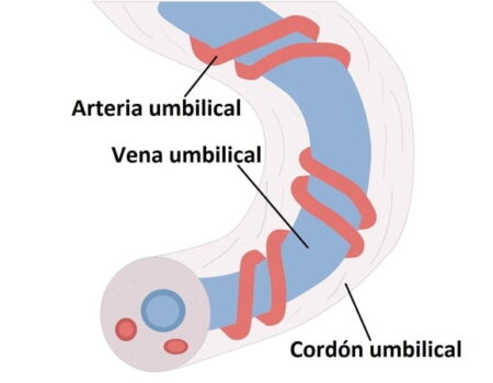 Arteria umbilical Arteria umbilical