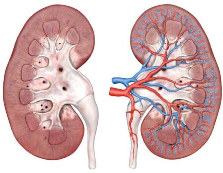 Arteria renal arteria renal