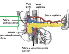 Arteria gastroduodenal