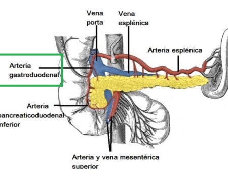 Arteria gastroduodenal Arteria gastroduodenal