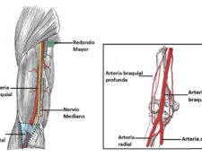 Arteria braquial profunda
