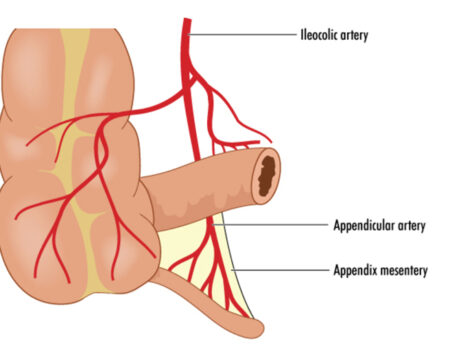 arteria ileocólica