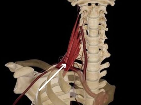 Tronco tirocervical Tronco tirocervical